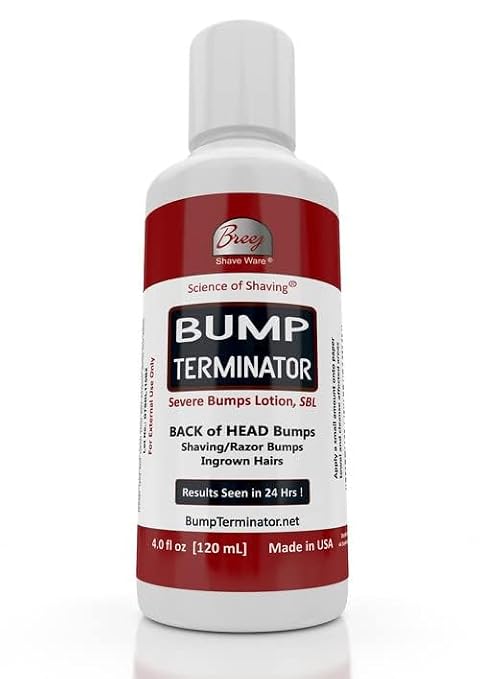 BUMP TERMINATOR Severe Shaving Bumps, Razor Bump, Ingrown Hairs Lotion 4 oz
