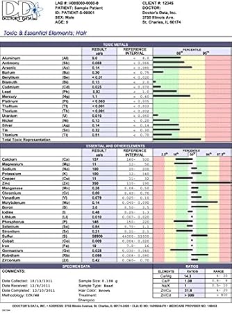 Hair Mineral Analysis