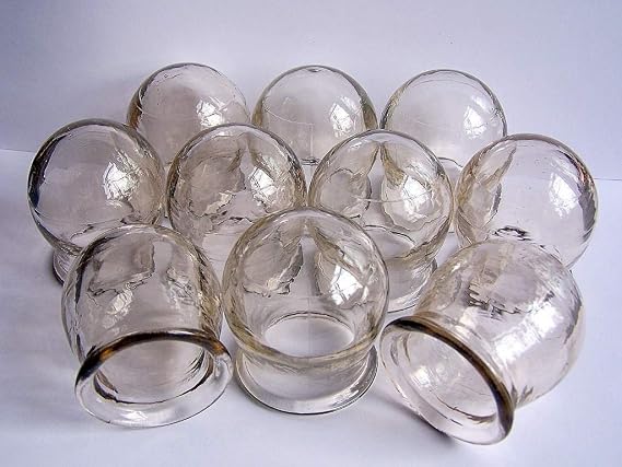 Chinese Massage Therapy. Set of 10 Glass Massage Cups. Cupping Jars, USSR